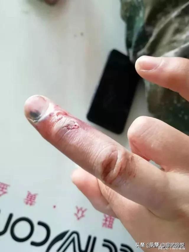 疫情面前我们该怎么去生活 (疫情期间你熬住了吗)