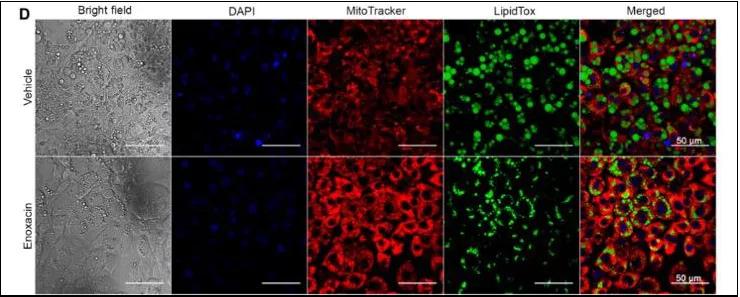 这种抗生素或可成为一种减肥新药