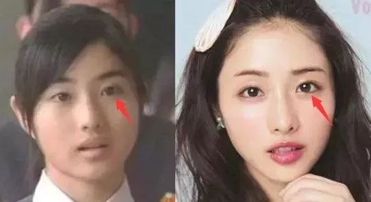 韩国与日本整容哪家强,日本整容vs韩国整容