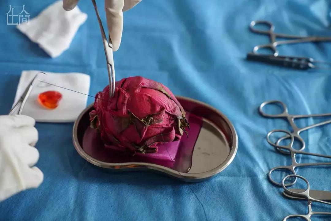 香蕉割包皮，洋葱剖腹产？这是我见过最秀的医生