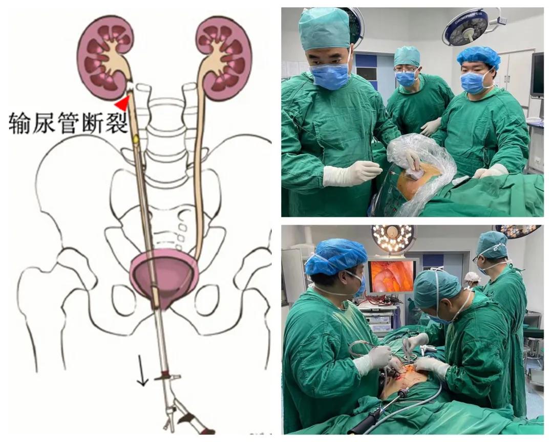 疫情期间门诊危急重症病人处置,疫情紧急救援视频惊心动魄