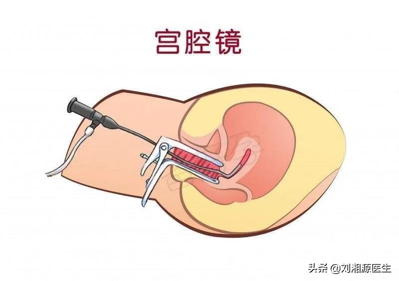 免疫不良妊娠可以通过中药治疗吗,免疫相关不良妊娠答疑解惑