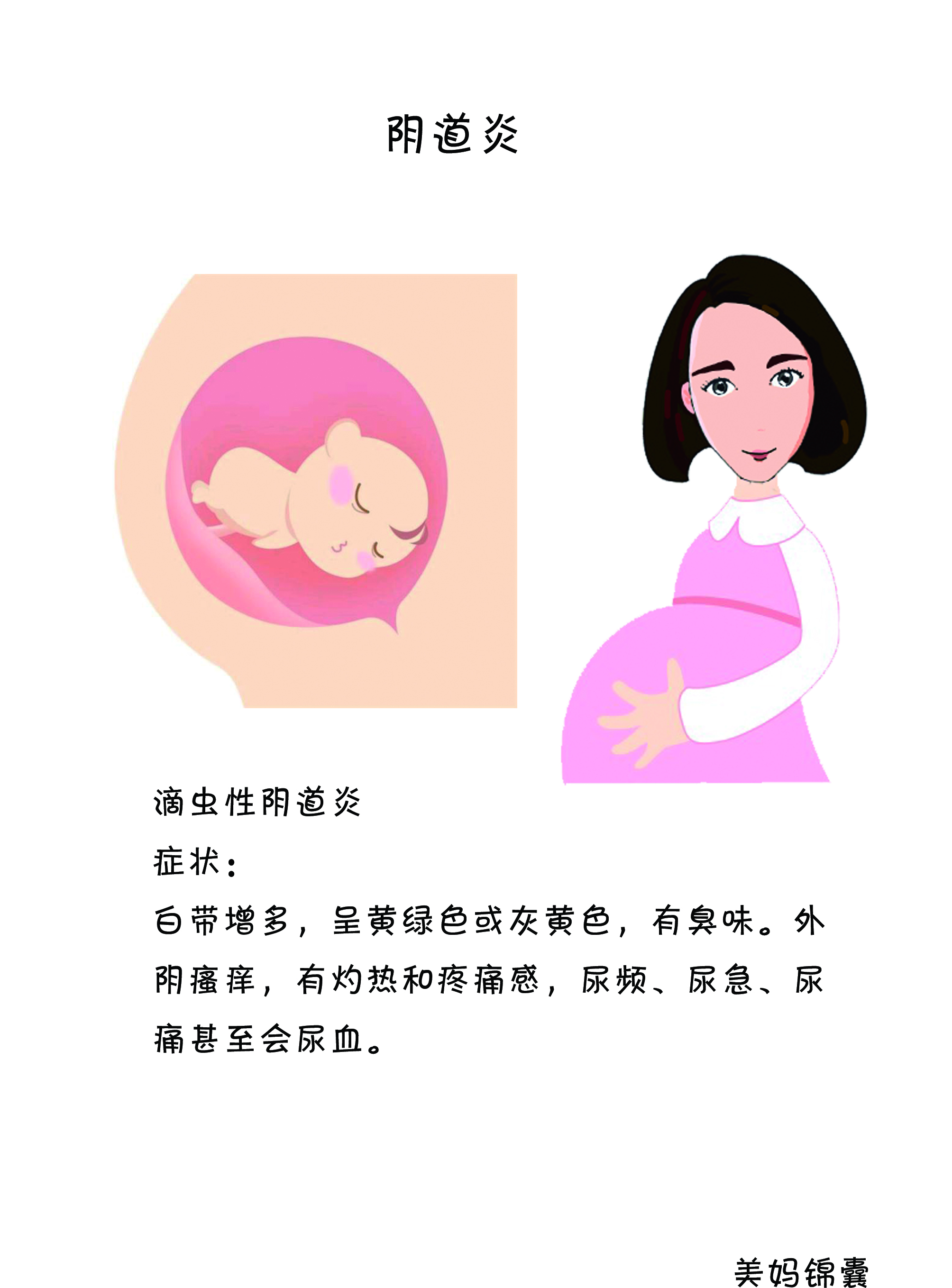 孕期阴道炎该如何护理？