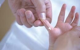 小孩推拿完打嗝怎么回事,小儿打嗝怎么推拿