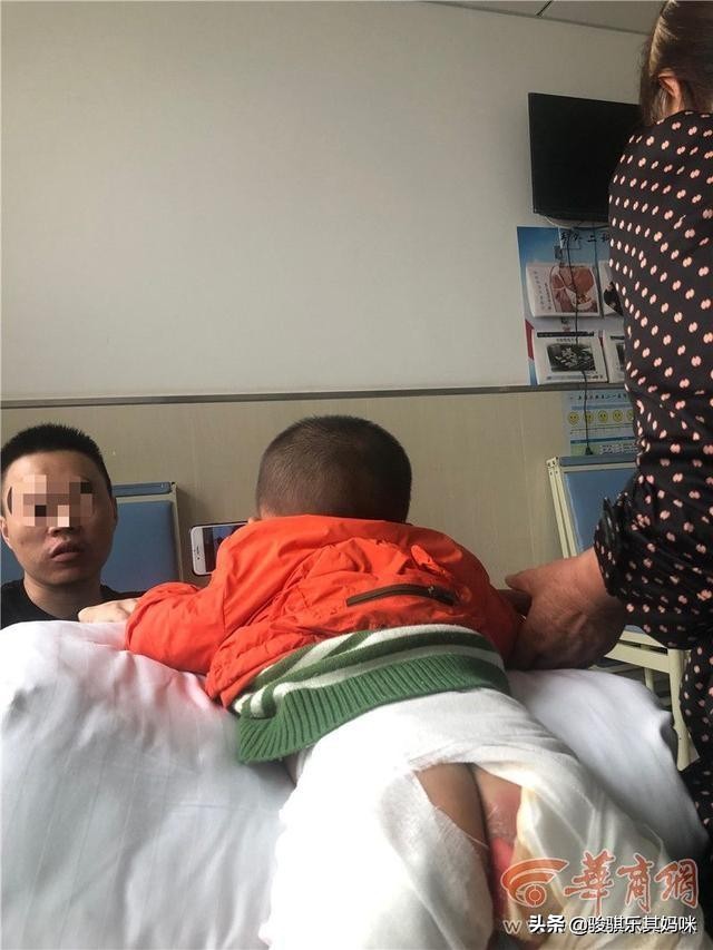 小孩子被二级烫伤后果,孩子被开水烫10级烫伤