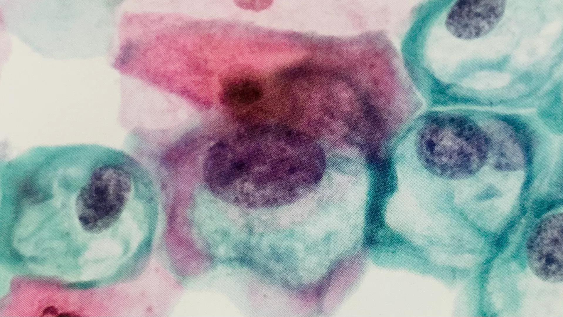 hpv感染可以打四价吗,hpv感染可以吃中药吗