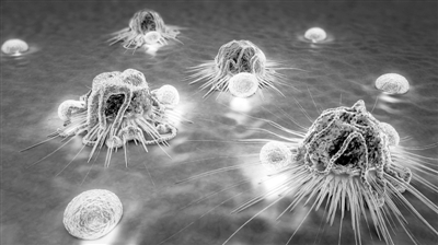 癌细胞标志物有哪些,肿瘤标志物如何判断是否有癌细胞