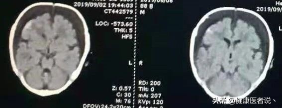 小孩头发卷曲是咋回事,小孩头发卷曲一根头发不均匀