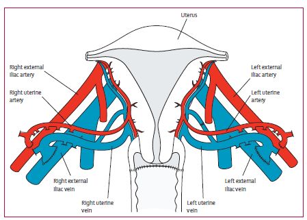 子宫移植手术成功案例都移植什么,目前国内能做子宫移植手术吗