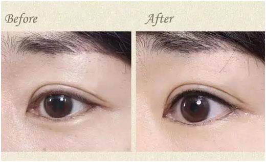 收藏美瞳,半永久美瞳线全过程教程