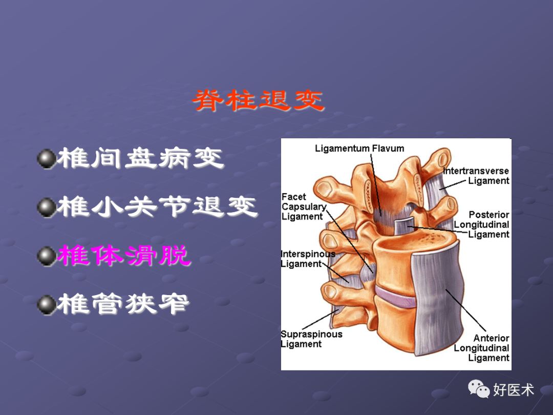 脊柱mri有哪些特点,乳腺疾病的mri诊断及鉴别