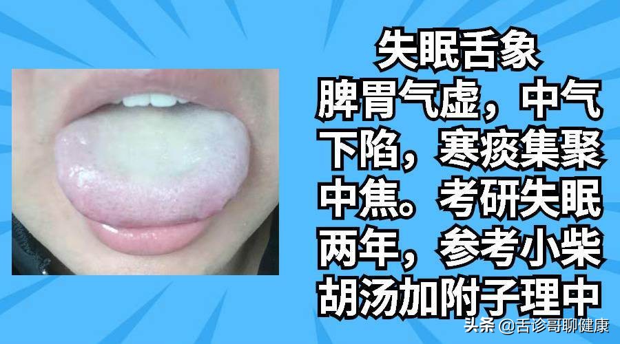 舌诊哥舌象分析视频,舌诊歌健康问答全集