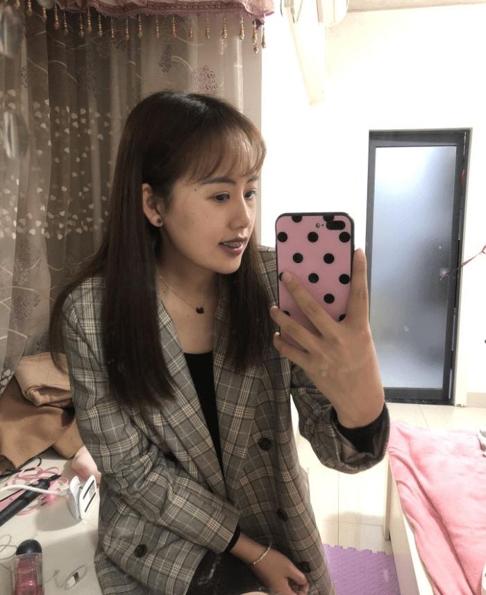 牙套隐形日记,牙套日记正颌