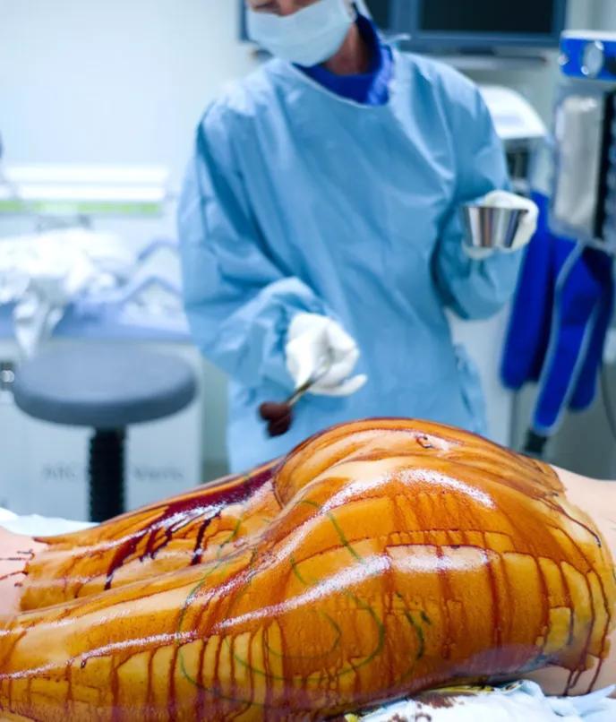 减肥反弹的具体原因有哪些,减肥反弹真相大公开