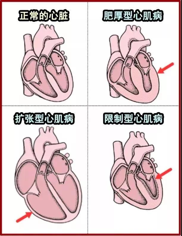 纯种猫可能会得的病,铲屎官怀疑自家猫咪是只法国猫