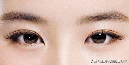 眼综合是前内眼角还是外眼角,双眼皮开内眼角和外眼角的区别