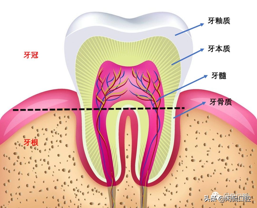 牙齿蛀牙多久会完全蛀掉,牙齿被虫蛀空了怎么修补