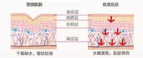 *血丝红**的自救指南,大家快来抄作业