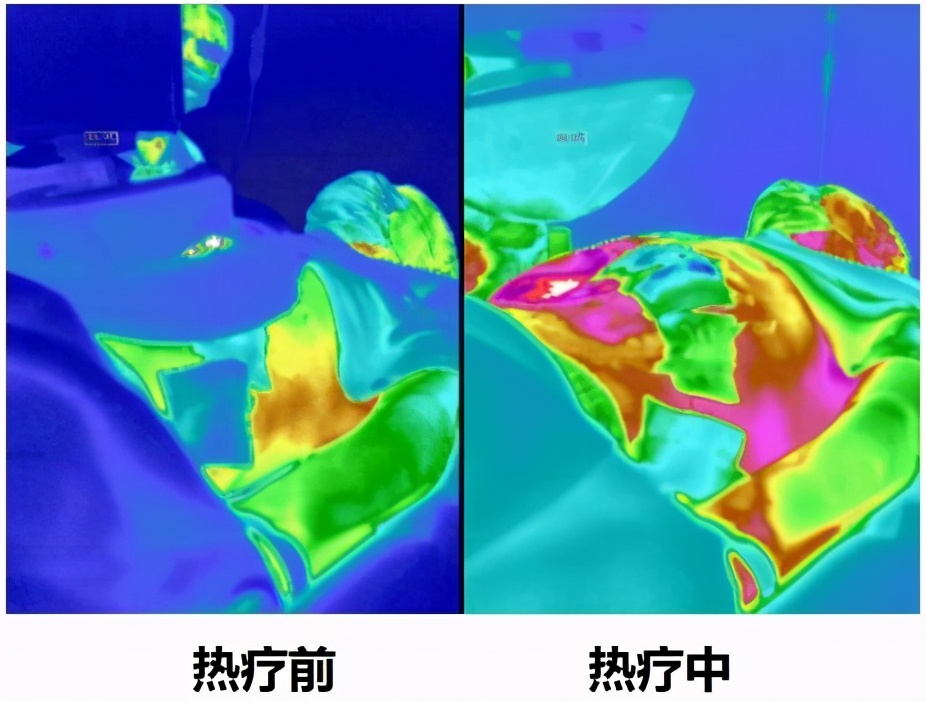 注射一针疫苗，就能杀死身上所有癌细胞，这种理想离实现有多远？