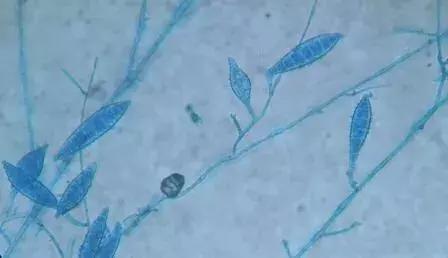 猫癣传染给人的症状,猫身上有猫癣怎么办