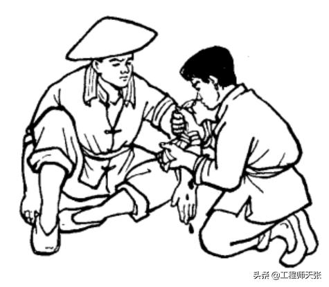 浙江男子走夜路被剧毒蛇咬,成功自救!做法实用,比教科书还经典