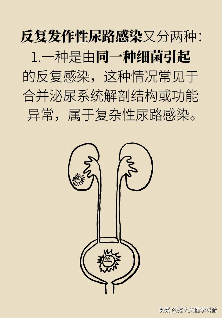 老人尿路感染会反复发烧吗,老年尿路感染反复发作怎么治疗