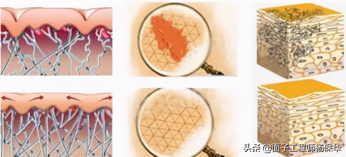 疤痕改善什么时候做合适,疤痕修复的五大忌