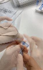 面膜这样敷效果才好补水效果超赞,敷了补水面膜起了很多皮