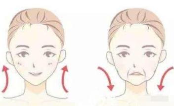 法令纹最显老怎么去除法令纹,法令纹太深了怎么改善