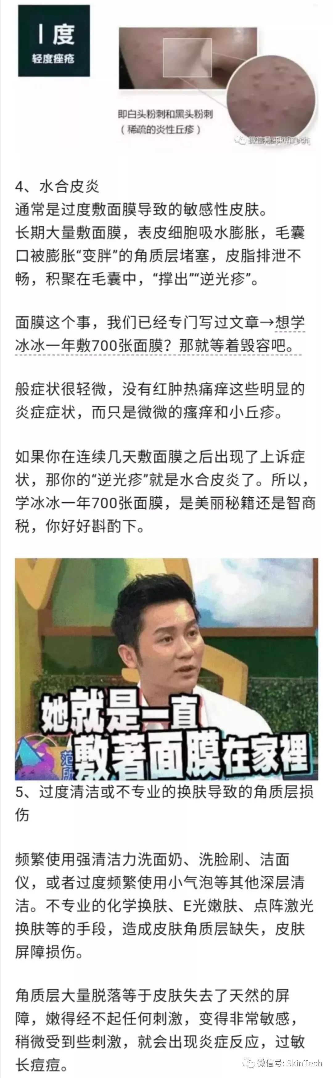 辟谣逆光疹,逆光疹是伪概念吗