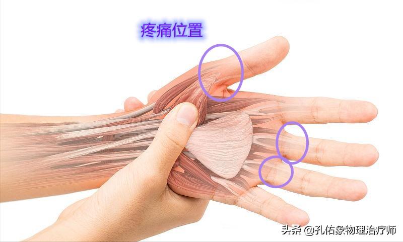 手指肿胀有硬硬的感觉,手指有结节有僵硬疼痛是什么病