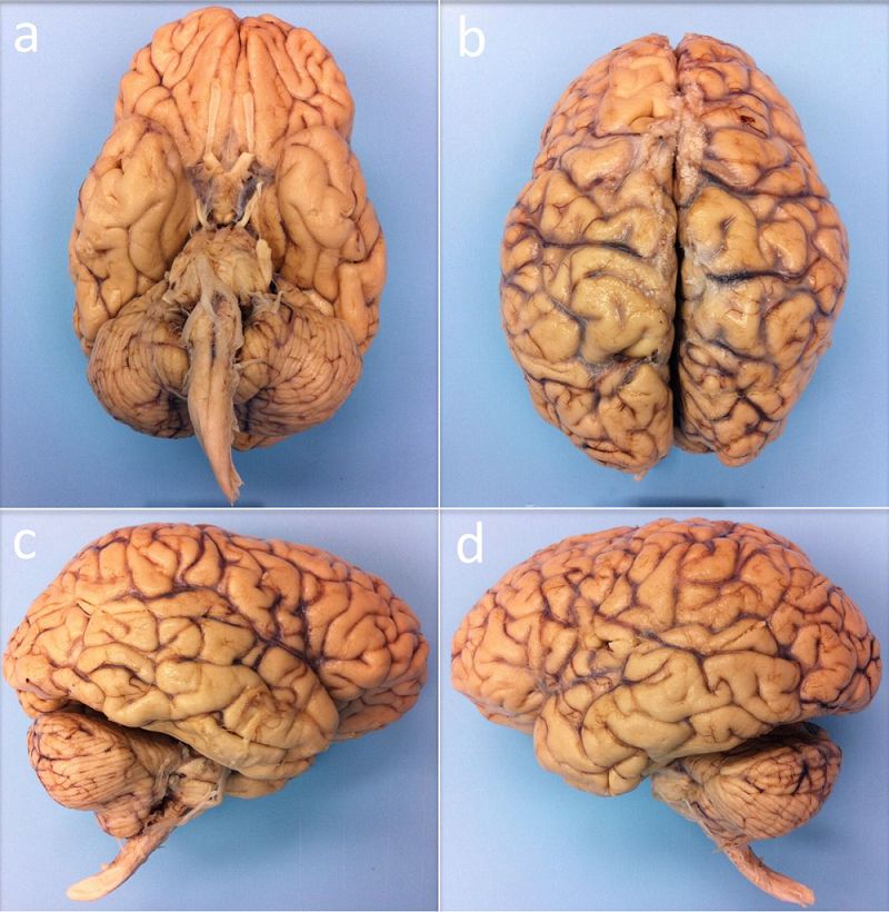 人类最完整大脑三维图像出炉,人类大脑最完整的三维立体图像
