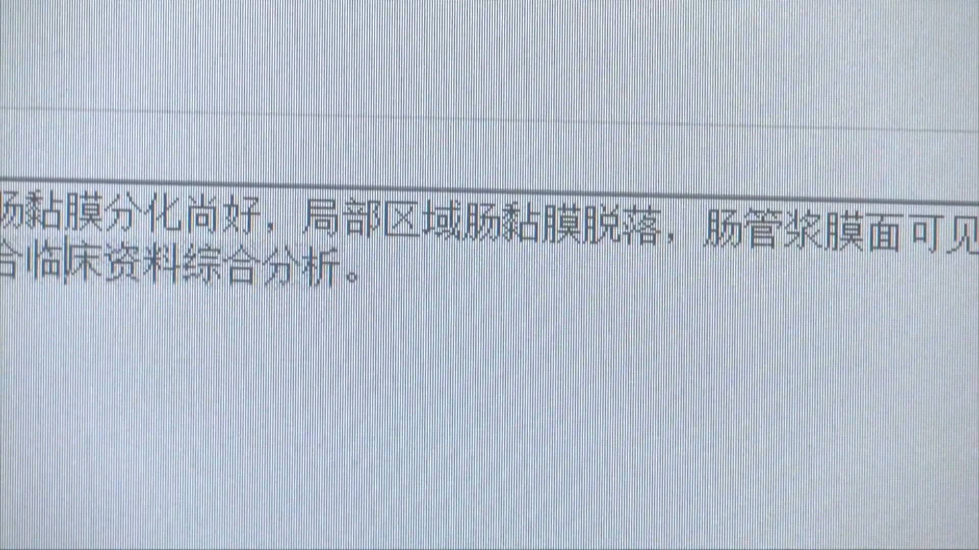 70岁老人灌肠犯法吗,长期灌肠排便对身体有什么危害
