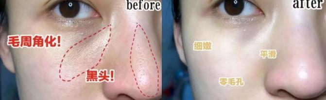 张韶涵护肤全部产品,张韶涵海蓝之谜