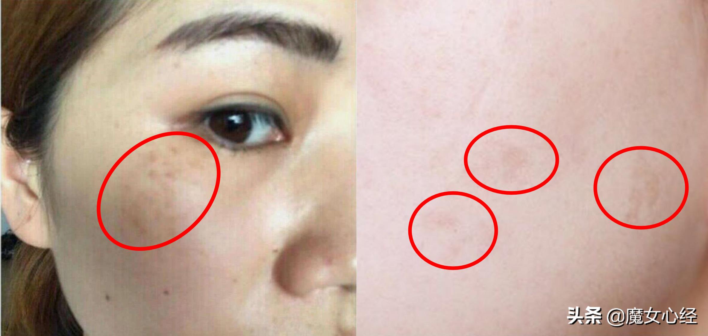 先上遮瑕还是先上粉底液比较好,底妆是先上防晒还是先上隔离