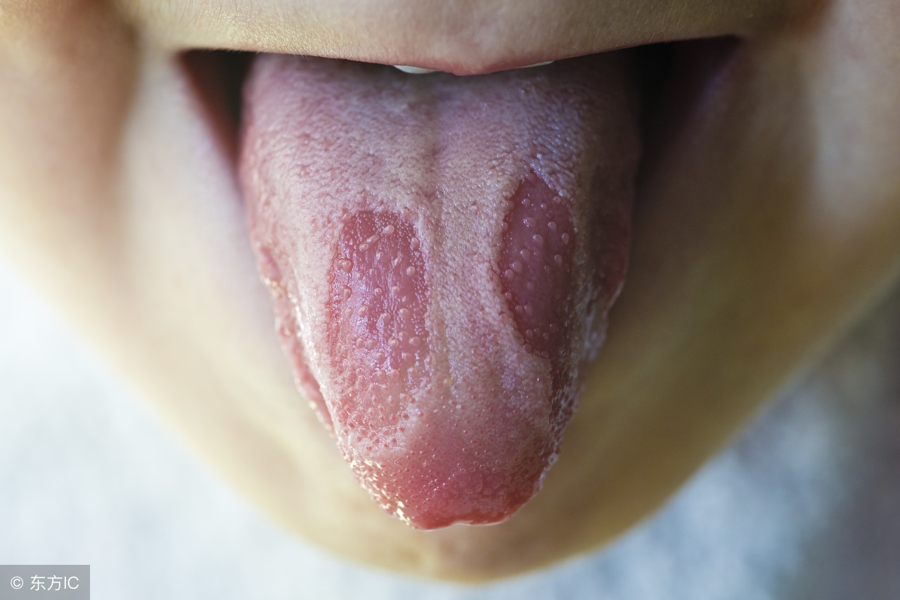 看宝宝舌头知病,从宝宝的舌头看身体