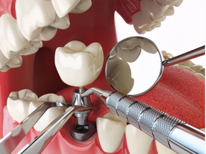 牙齿受不了薄荷牙膏,牙齿受不了果酸的刺激