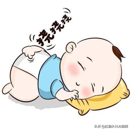 一周岁宝宝得了肛瘘可以做手术吗,婴幼儿得了肛瘘怎么治疗