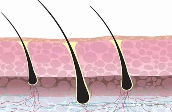 毛囊萎缩脱发是什么样子,毛囊萎缩是毛囊闭合吗