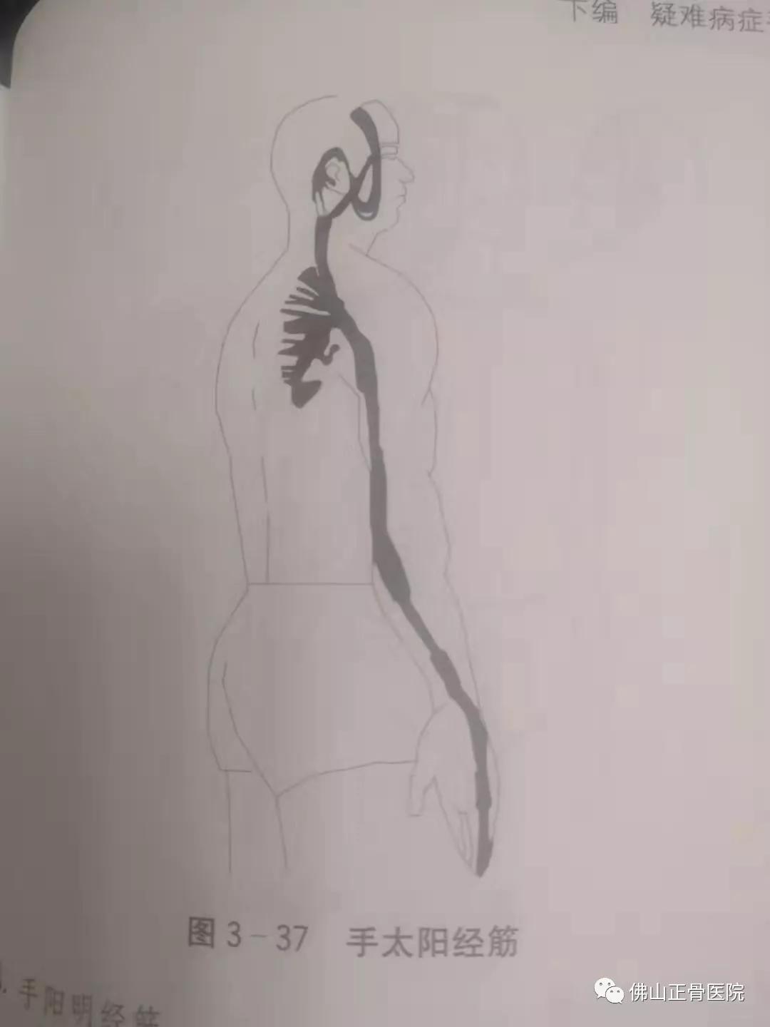 经筋手法，我院名誉院长国医大师韦贵康《韦氏骨伤手法集成》