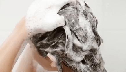 一个月脱发治疗最好的方法,真实分享严重脱发解决办法