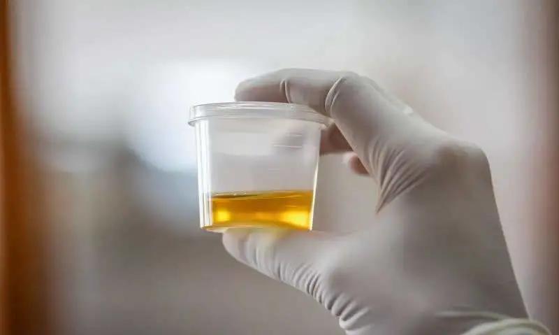 24小时尿液怎么收集才正确,怎么样正确收集24小时尿液动画