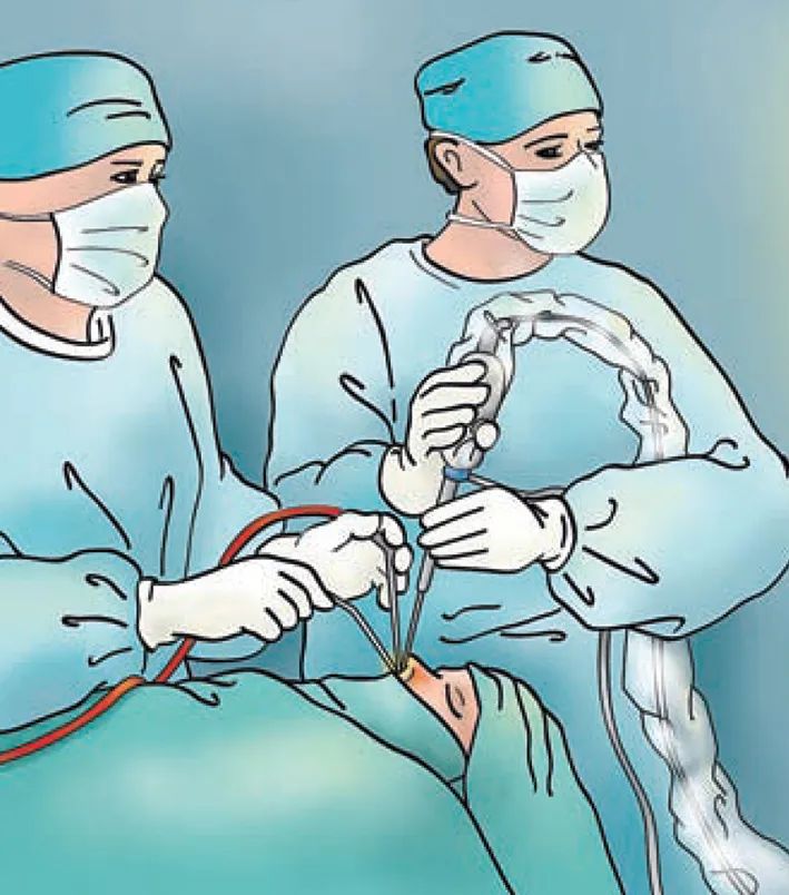 脑子里有4毫米的瘤,脑子里为什么会长瘤