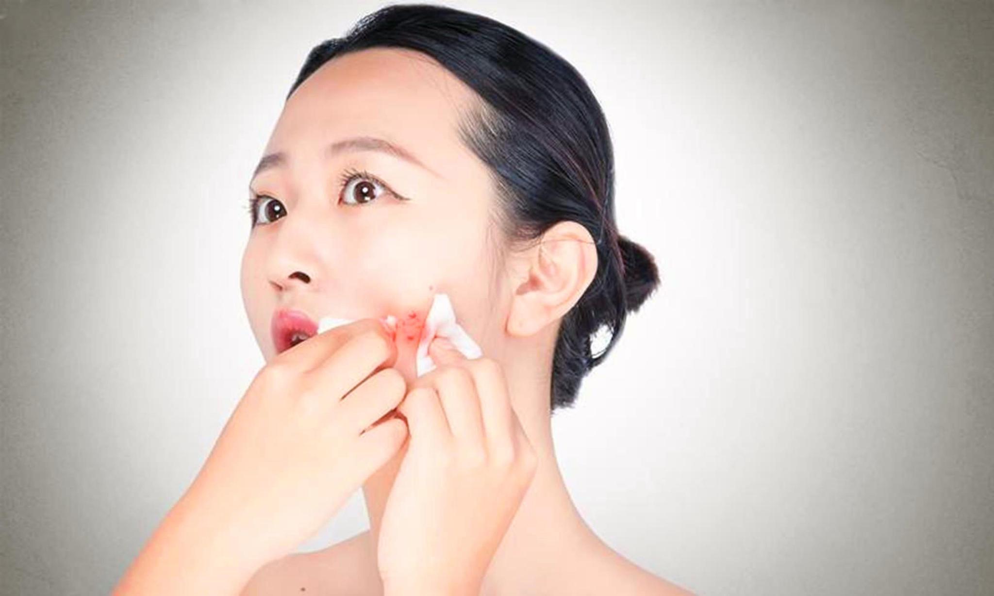 喝增肌粉爆痘需要补充什么,为什么喝增肌粉容易爆痘