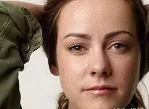 脸上干燥起皮怎么办夏天,脸上干燥起皮喝水也没用