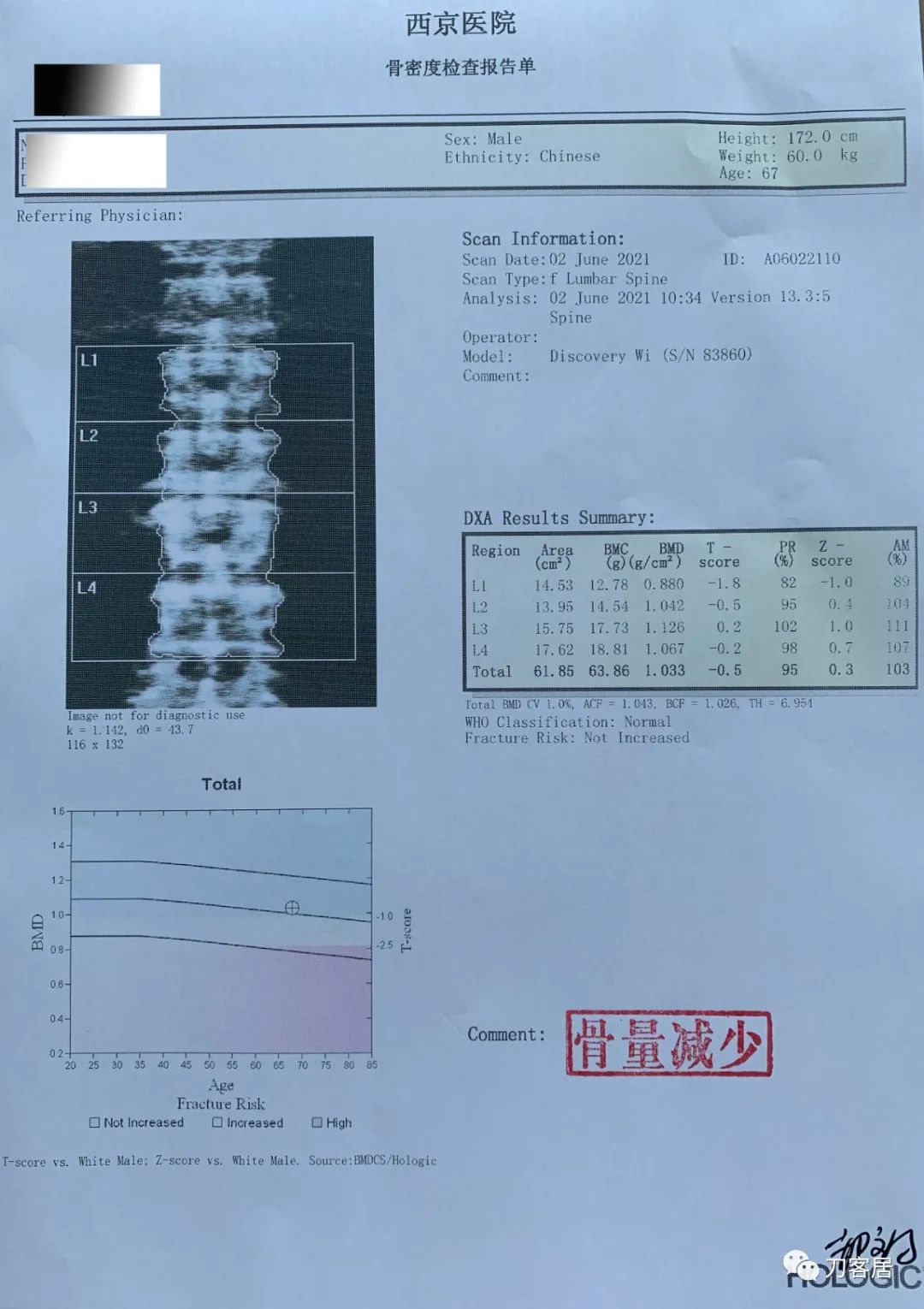 颈椎3-7节椎间盘突出需要微创治疗,颈椎4-7节椎间盘突出怎么治疗