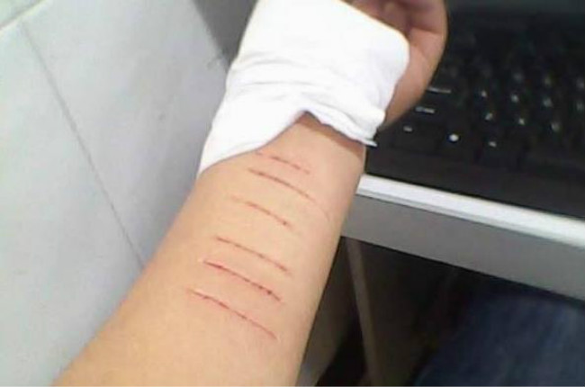 孩子生气自残行为危害,孩子生气自残的原因