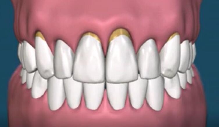 狗狗洗牙的良心忠告,医生忠告千万别洗牙