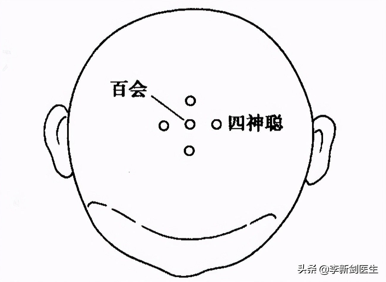 多发性抽动症眨眼睛怎么办,多发性抽动症中药治疗方法