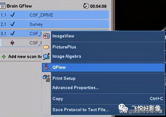 飞利浦磁共振快速扫描方案指南,飞利浦1.5t磁共振各部位扫描技术